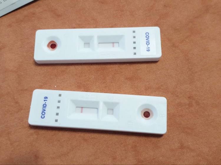 Corona-Massentests noch vor Weihnachten