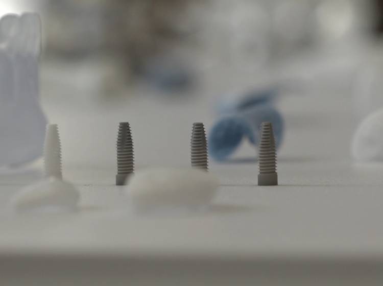 Weltneuheit: Kieferimplantat aus dem 3D-Drucker